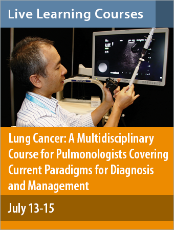 Lung Cancer: A Multidiscliplinary Course for Pulmonologists Covering Current Paradigms for Diagnosis and Management July 2018